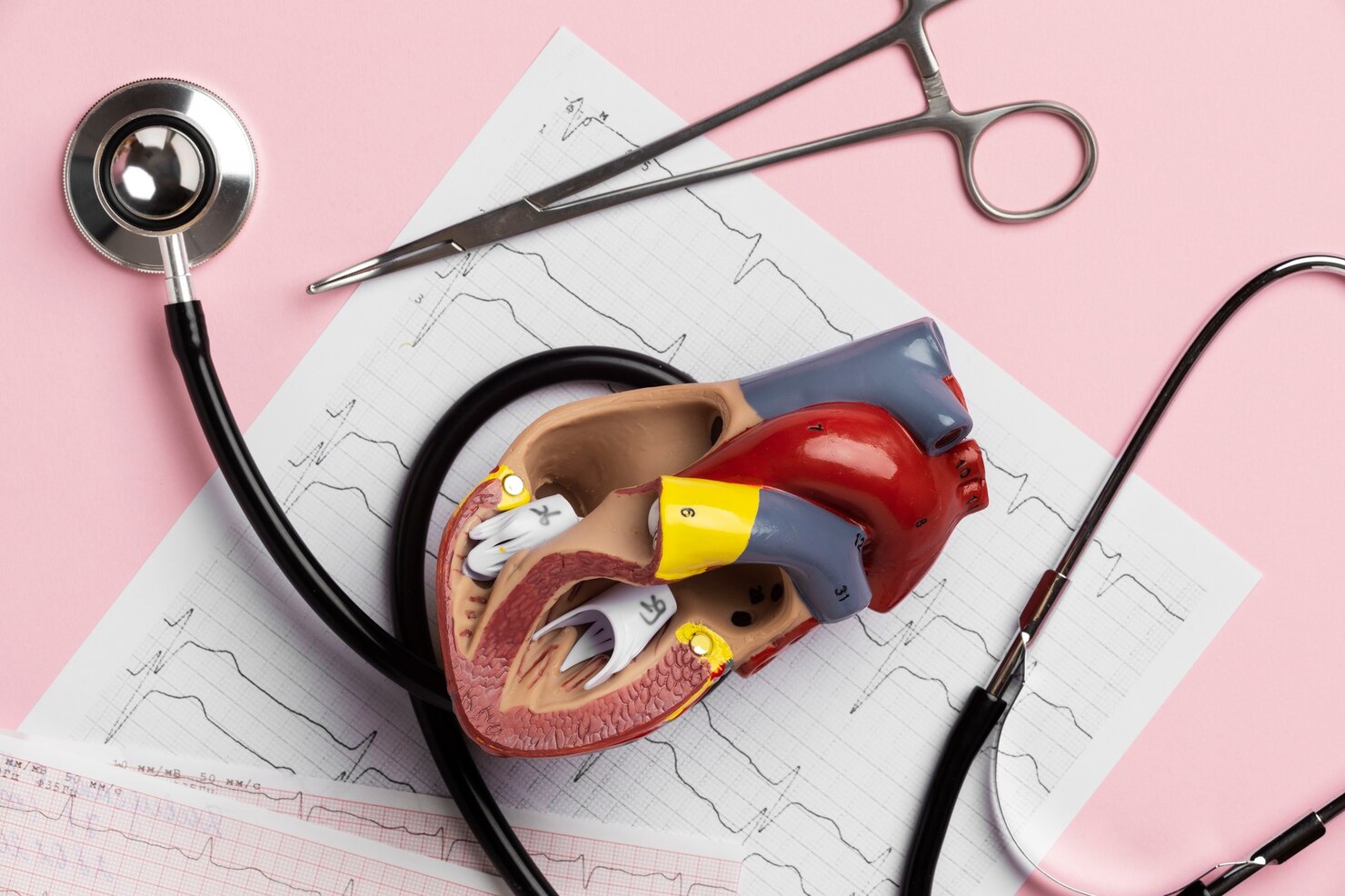 Heart Doc Coronary Angiography Test in London | Heart Doc